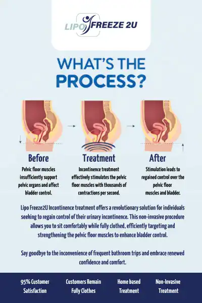 Diagram of how incontinence treatment Royal Leamington Spa works.
