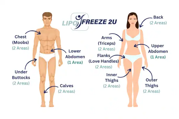 Areas you can have fat freezing treatment Royal Leamington Spa