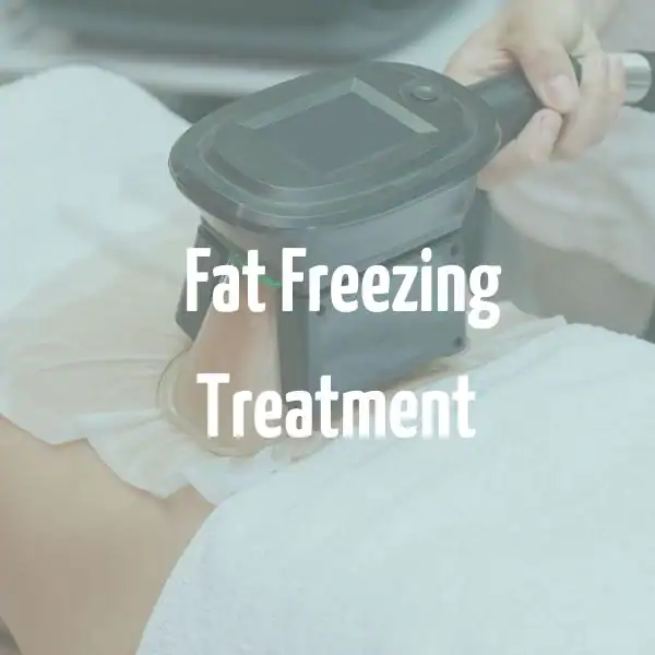 fat freezing treatment Royal Leamington Spa