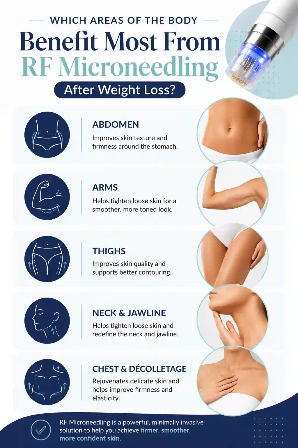 Which Areas of the Body Benefit Most From RF Microneedling After Weight Loss Royal Leamington Spa